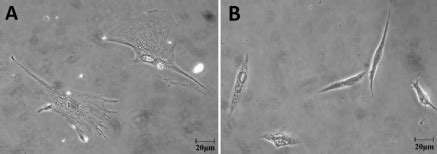 All Trans Retinoic Acid Regulates The Expression Of The Extracellular