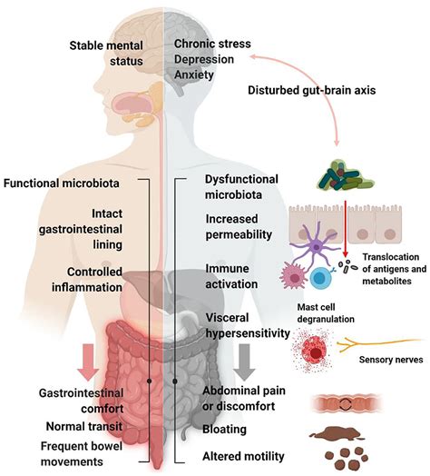 Frontiers Increasing Evidence That Irritable Bowel Syndrome And