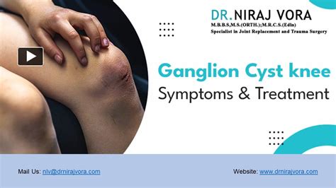 Ppt Ganglion Cyst Knee Symptoms And Treatment Dr Niraj Vora Powerpoint Presentation Free