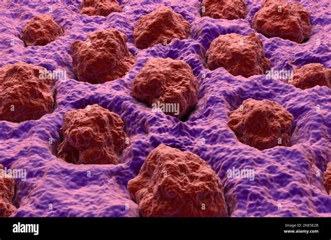 Human Tongue Surface Mucosa With Papillae Isometric View 3d