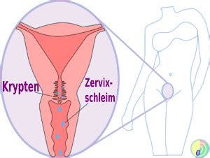 Blutiger Zervixschleim Was Bedeutet Er