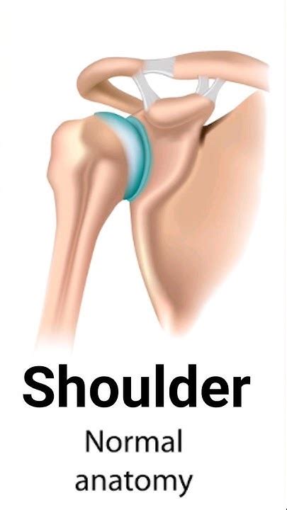 Shoulder Dislocation Types Shorts Short Youtube