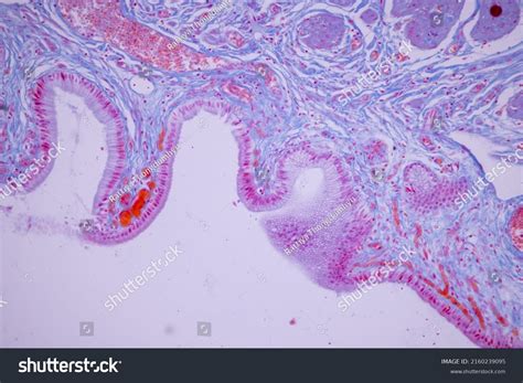 Columnar Epithelium Human Gall Bladder Under Stock Photo 2160239095