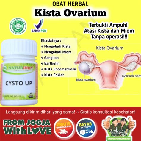 Jual Obat Kista Ovarium Kista Bartholin Kista Endometriosis Kista Miom