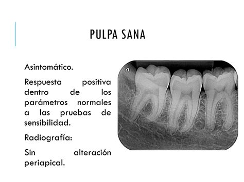 Unidad 3 Enfermedades De La Pulpa Y Tejidos Periapicales 1 Pdf