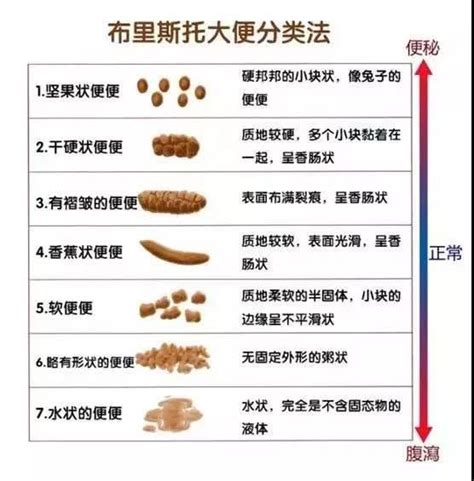 从大便形状看肠道健康：对照5个特点，排除疾病可能