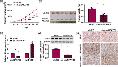 Circnfatc3 Facilitated The Progression Of Oral Squamous Cell Carcinoma