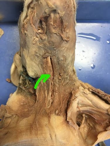 Lab Exam Pig Muscles Flashcards Quizlet