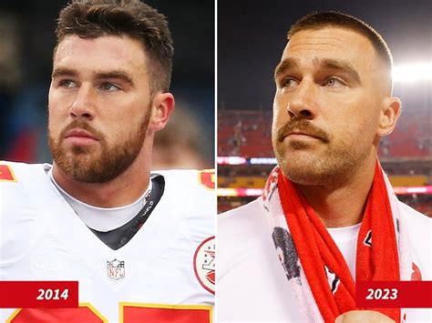 News And Vibes | Travis Kelce — Good Genes Or Good Docs?!