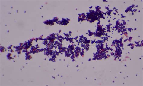 Cocci Bacteria Under Microscope