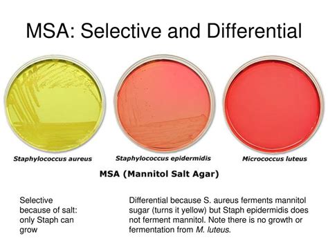 Macconkey Agar Composition Principle Uses And Procedure Off