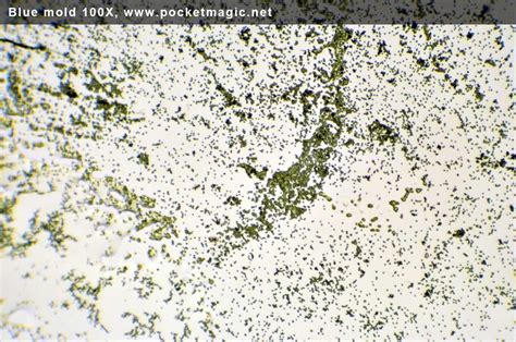 Black Mold Under Microscope : Rhizopus bread mold under the microscope. Rhizopus bread ...