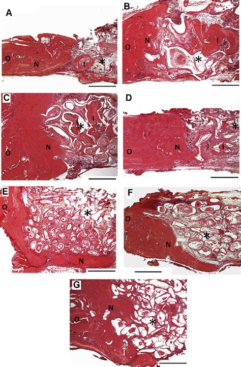 Photomicrographs Of H E Stained Sections Of Rat Calvarial Defects