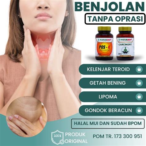 Jual Obat Benjolan Herbal Ampuh Lipoma Gondok Kelenjar Tiroid