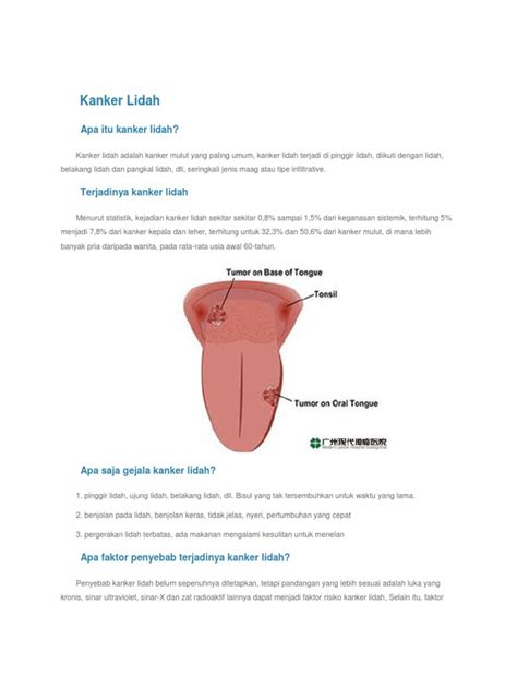 Kanker Lidah Pdf