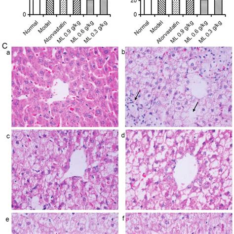 Effects Of Ml On Serum Lipid Levels And Fecal Tc And Tba Levels In