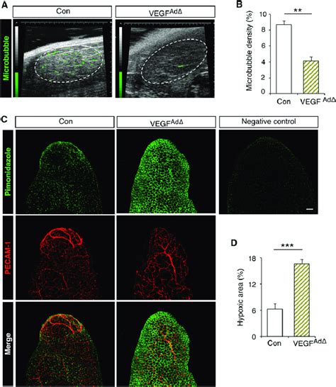 Consequences Of Adipose Tissue Hypoperfusion In Vegf Add Mice