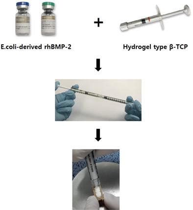 Effectiveness And Feasibility Of Injectable Escherichia Coli Derived