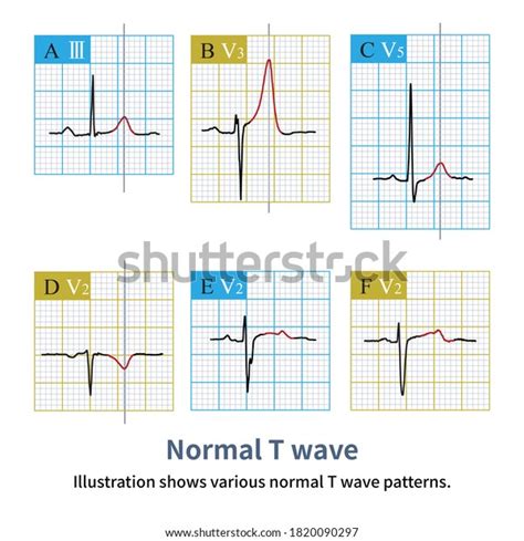 morphologies normal  waves stock illustration