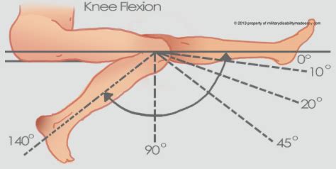 3 Considerations when Preparing for Total Knee Replacement - 360 Orthopaedics