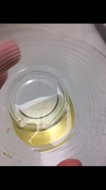 White particles in urine, what is it? - Glow Community