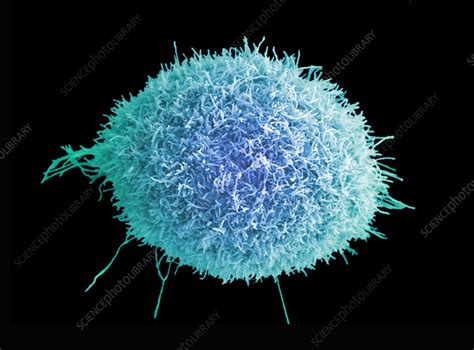 Cervical Cancer Cell SEM Stock Image C059 3628 Science Photo Library