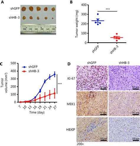 Hbxip Knockdown Inhibits Non Small Cell Lung Cancer Development In