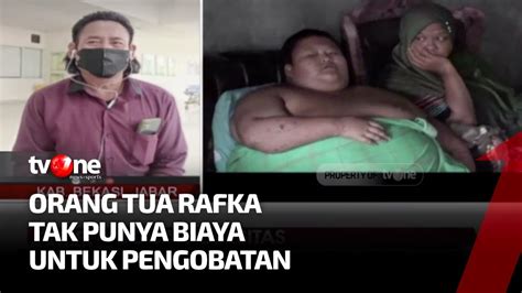 Dulu Ada Arya Permana Kini Rafka Bocah Tahun Alami Obesitas