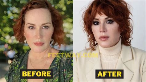 Molly Ringwald Plastic Surgery 2023 - Feetway