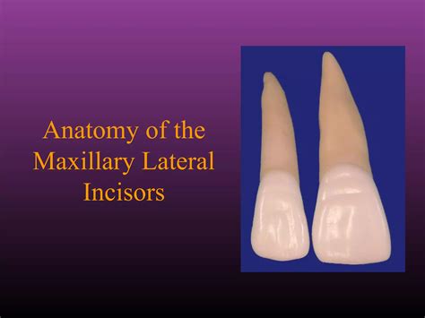 Maxillary Lateral And Mandibular Incisors PPT