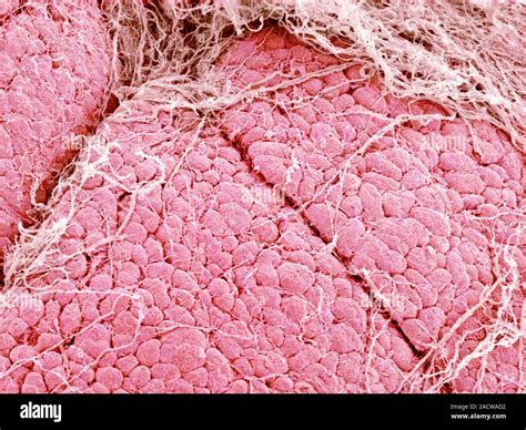 Lacrimal Gland Coloured Scanning Electron Micrograph Sem The