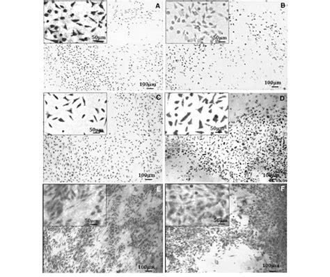 Optical Micrographs Of Osteoblast Like Cells Stained With Methylene