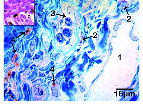 Light Micrograph Of The Lamina Propria Of The Nasal Septal Island