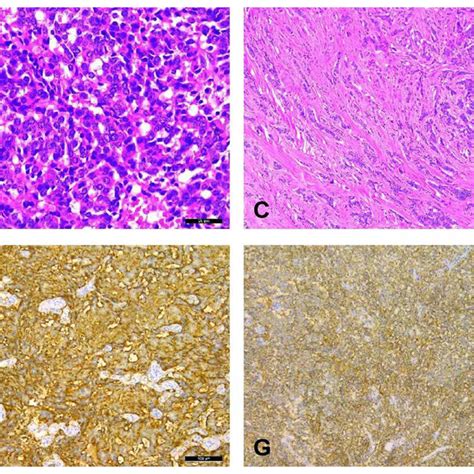 Gross Examination Of The Tumor Specimen A A Well Circumscribed Oval