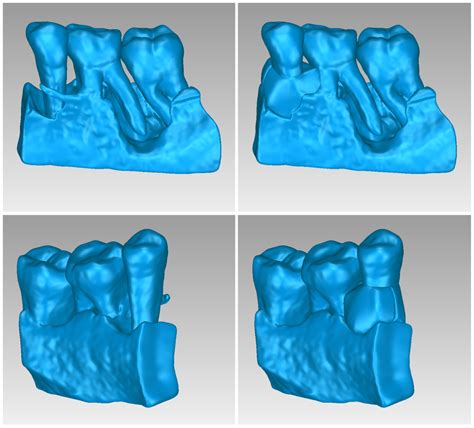 The Role Of Cone Beam Computed Tomography In Periodontology From D