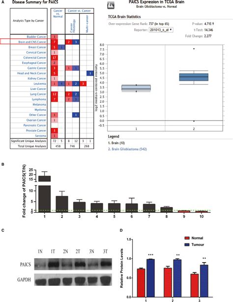 Expression Levels Of Paics In Glioblastoma Tissues A Expression