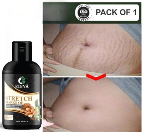 Ribva Present Stretch Marks Removal Oil Natural Heal Pregnancy Hip