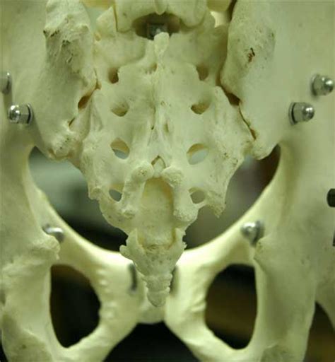 Sacral Vertebrae