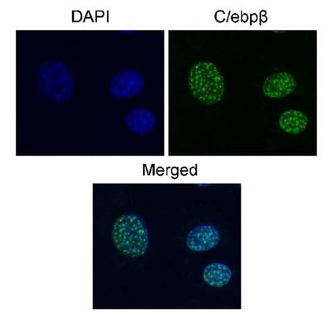 Cebp Beta重组抗体 E299 Cebp Beta抗体ab32358 Abcam中文官网