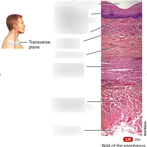 Esophagus Layers Diagram | Quizlet