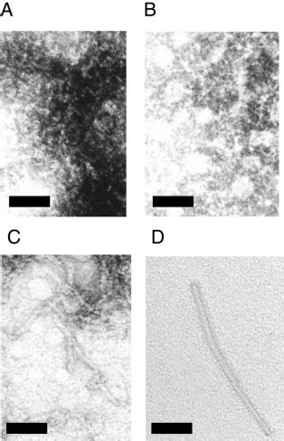 Electron microscopy using uranyl acetate negative staining at 98,000 ...