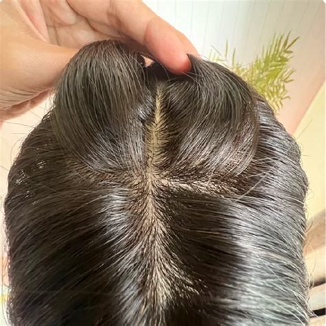 top hair replacement systems  option  hair loss solutions