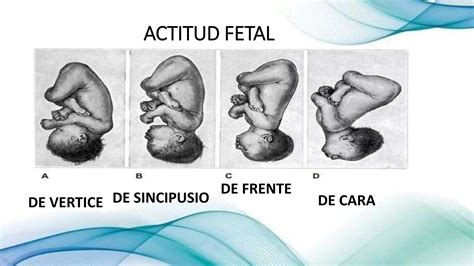 Estatica Fetalpptx