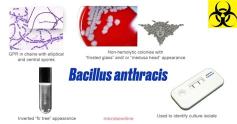 Bacillus anthracis: Properties, Pathogenesis, Lab Diagnosis • Microbe ...