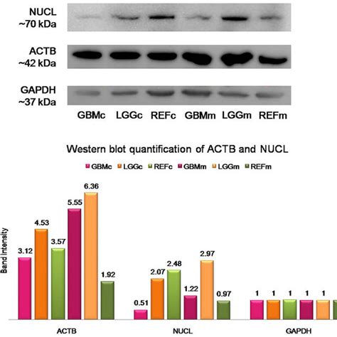 Western Blotting Validation And Quantification Of The Identified Download Scientific Diagram