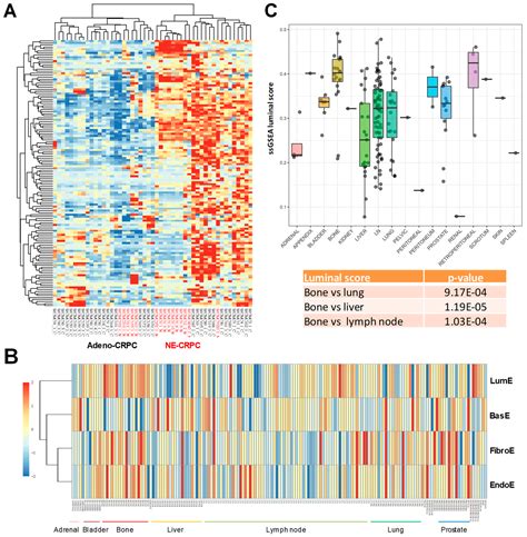 Cancers Free Full Text A Novel Prostate Cell Type Specific Gene