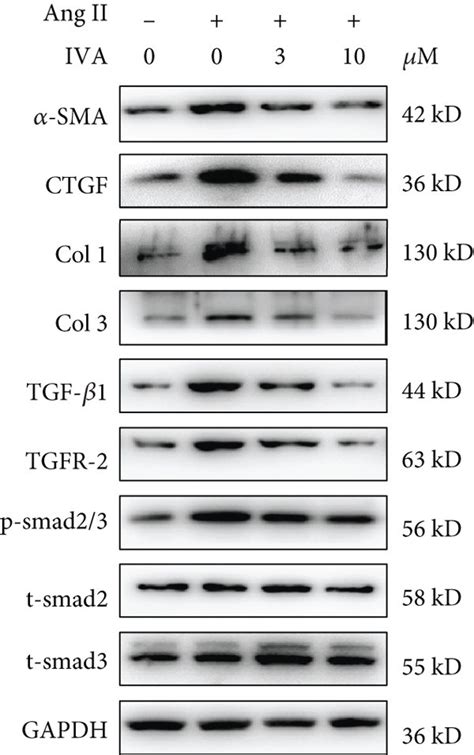 Iva Inhibited Cardiac Fibroblast Proliferation And Activation Primary