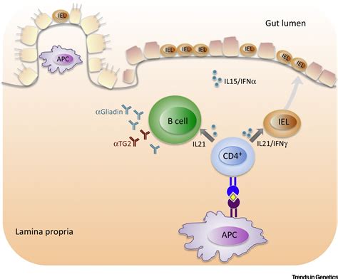 Understanding Celiac Disease By Genomics Trends In Genetics