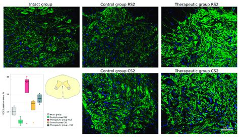 Immunofluorescence Staining Of The Ventral Horns Of The Spinal Cords In