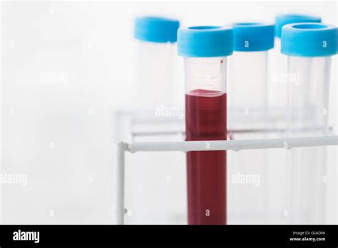 Blood sample in test tube Stock Photo - Alamy